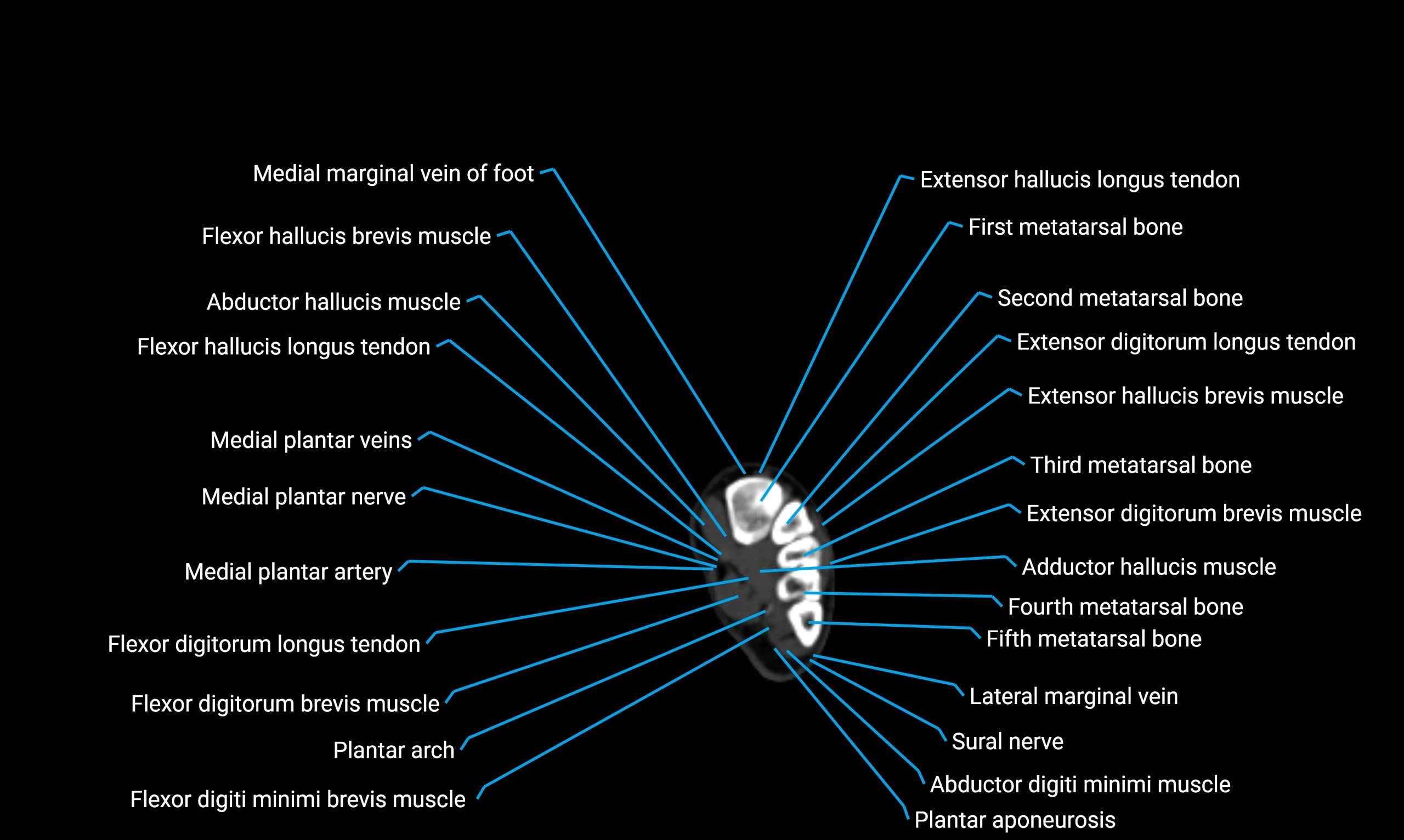 CT lower limb axial cross sectional anatomy labelled image 183 (2).webp